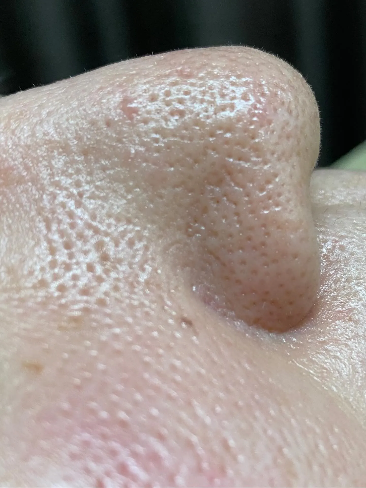 毛穴詰まりのお悩みでお困りですか?😣✨「毛穴の詰まり」や「肌...