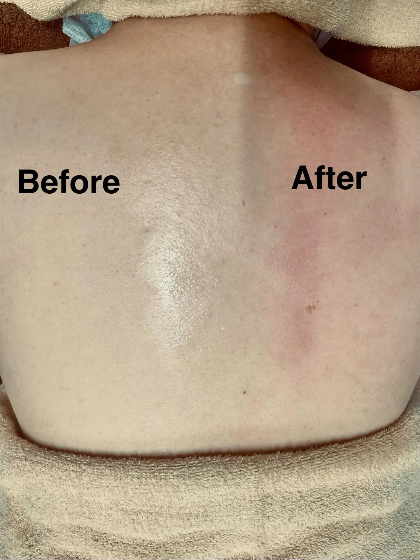 寒さで肩が巻き型になっていませんか？🥶 寒さや風が冷たいと、...