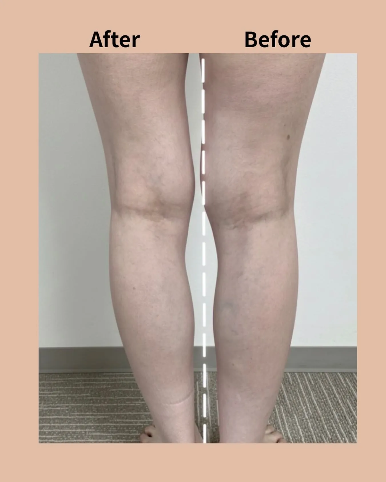 【浮腫み取り勉強会】