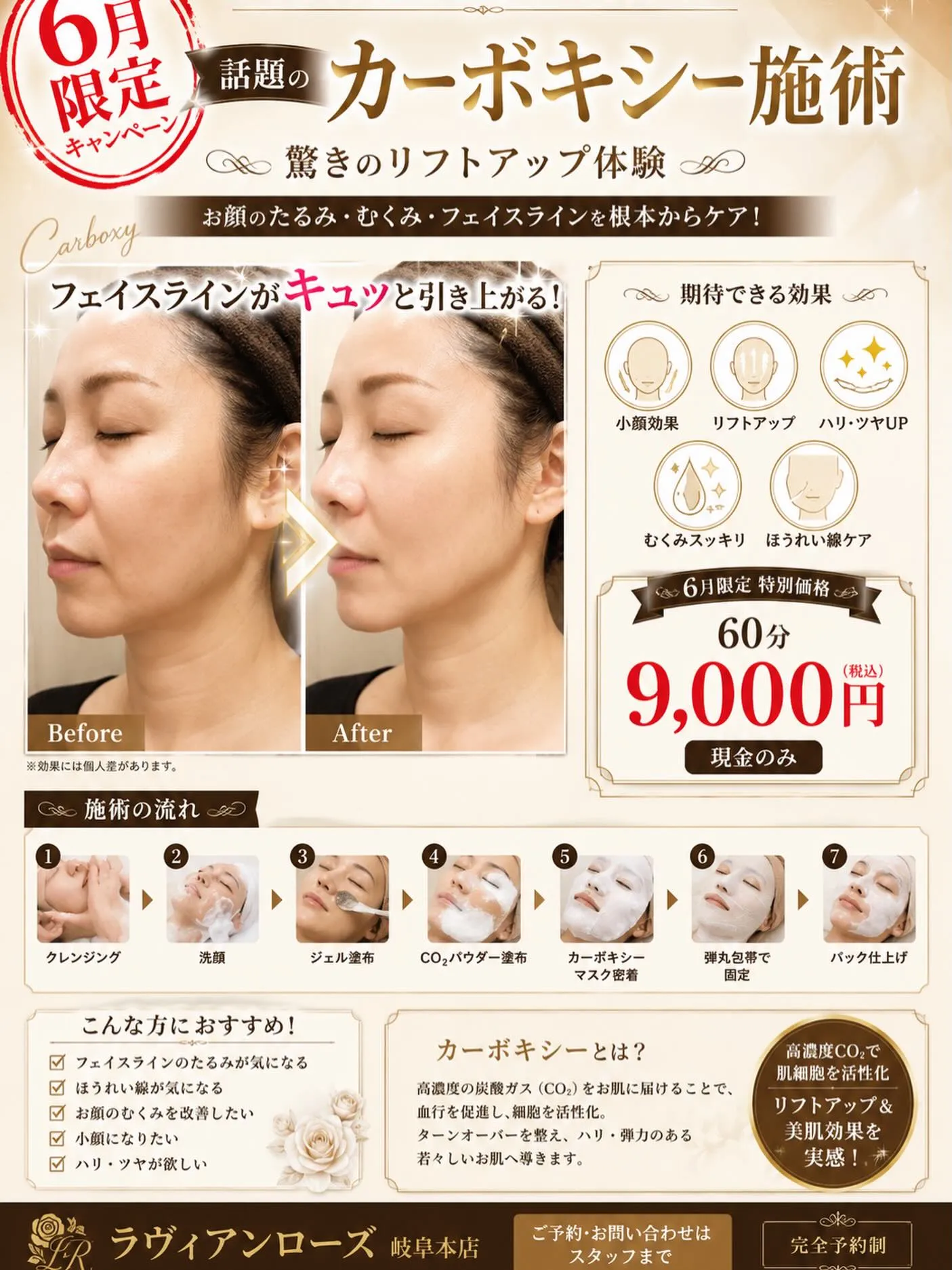 【6月限定】驚きのリフトアップ！話題のカーボキシーフェイシャ...