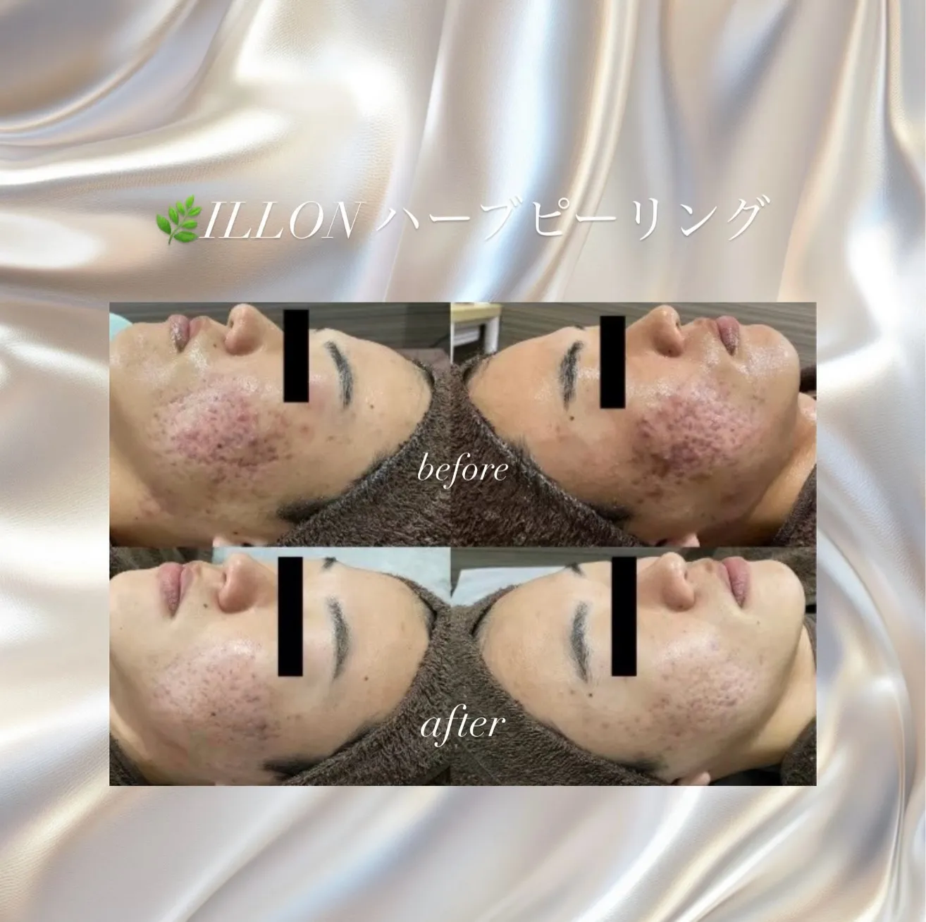 ⁡