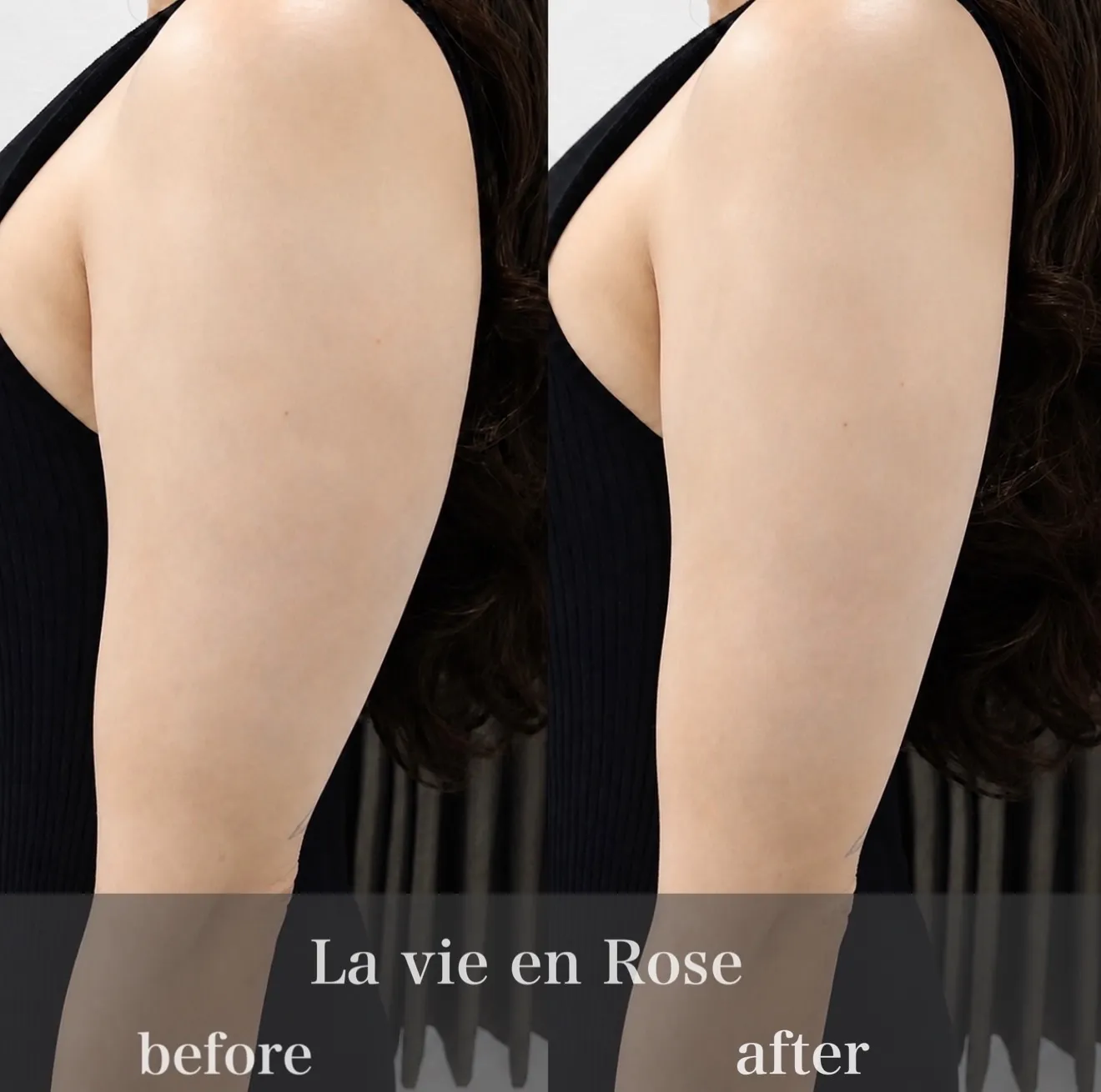 ✨️╲二の腕痩せのbefore＆after╱✨️